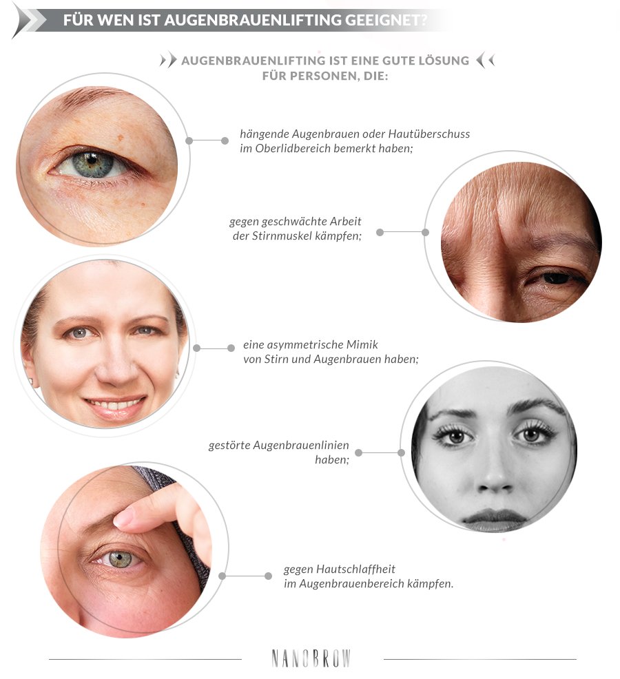Wann lohnt sich Brow Lifting?